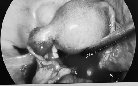 619094387_1517048380423603_2260431690757462555_n