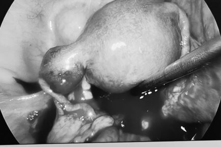 619094387_1517048380423603_2260431690757462555_n